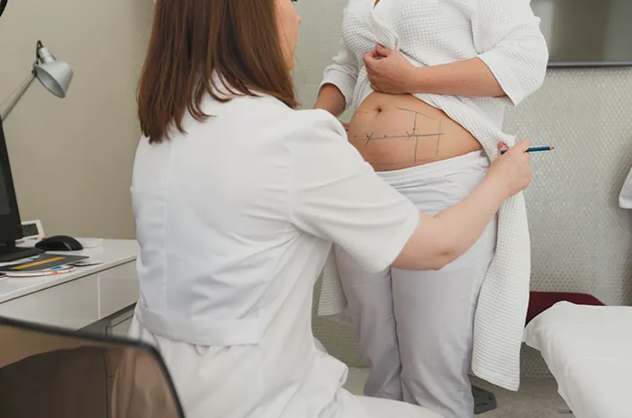 Mengatasi Komplikasi Sedot Lemak