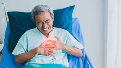 Atrial Fibrilasi Meningkatkan Risiko Stroke Iskemik