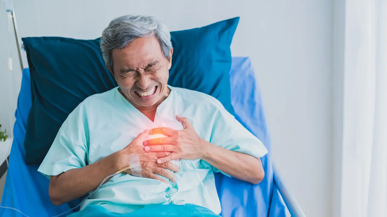 Atrial Fibrilasi Meningkatkan Risiko Stroke Iskemik